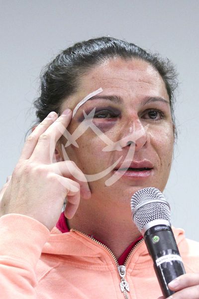 La campeona olímpica Ana Guevara pide justicia por agresión