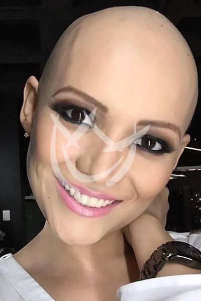 Karla Luna vs cancer