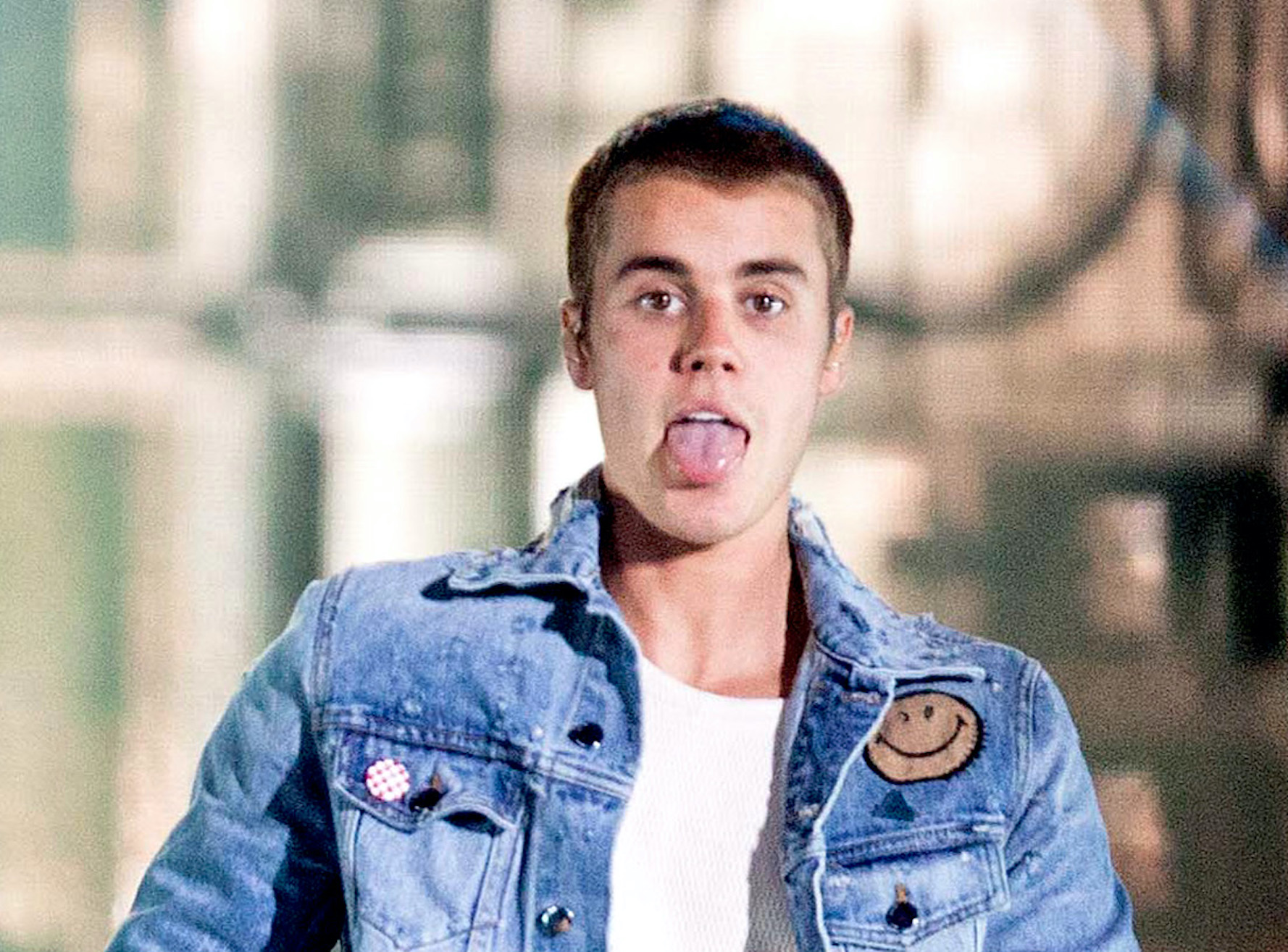 Justin Beiber tiene la mitad de la cara paralizada