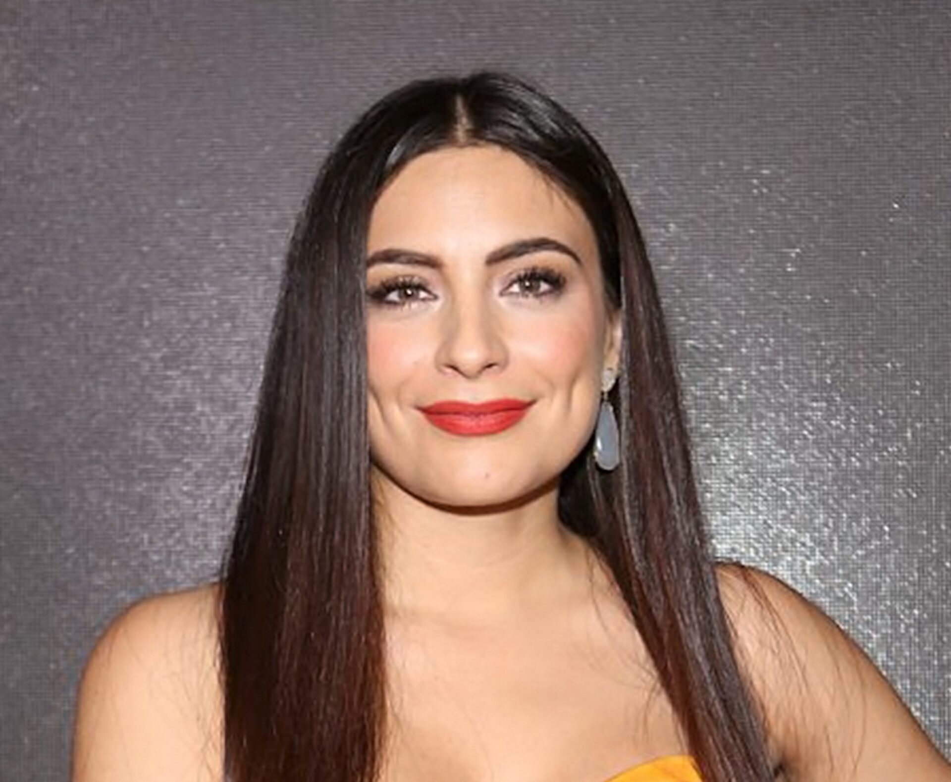 Ana Brenda Contreras tiene ronchas en la piel